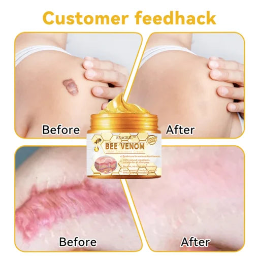 HOUKEA - Bee Venom Skin Care Cream (Original) (كريم العناية بالبشرة الأصلي بسم النحل)
