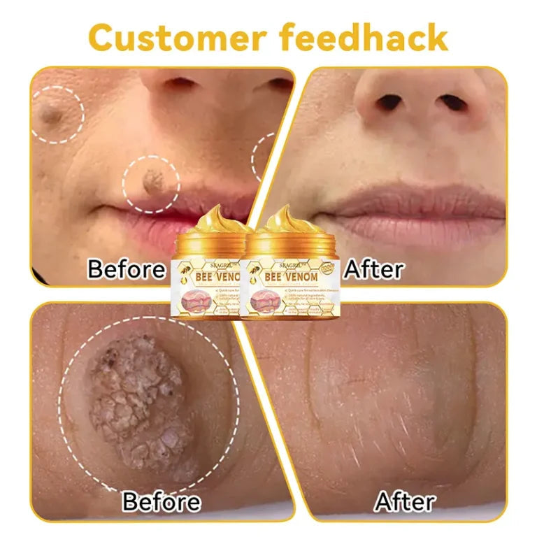 HOUKEA - Bee Venom Skin Care Cream (Original) (كريم العناية بالبشرة الأصلي بسم النحل)